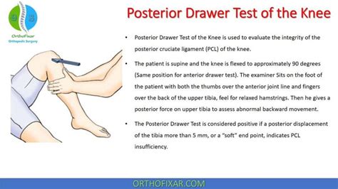 positive posterior drawer test